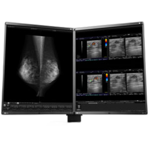 EIZO RX560 MammoDuo